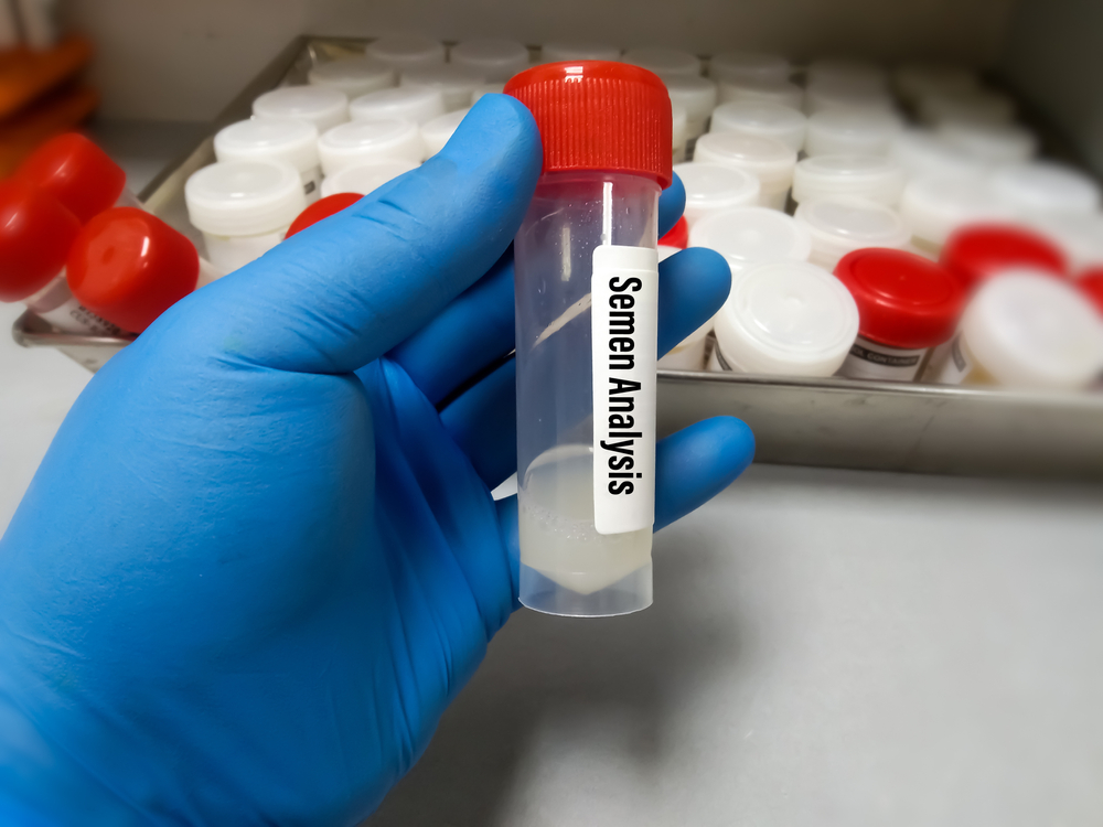blood test at home dubai 2025 Doctor On Call