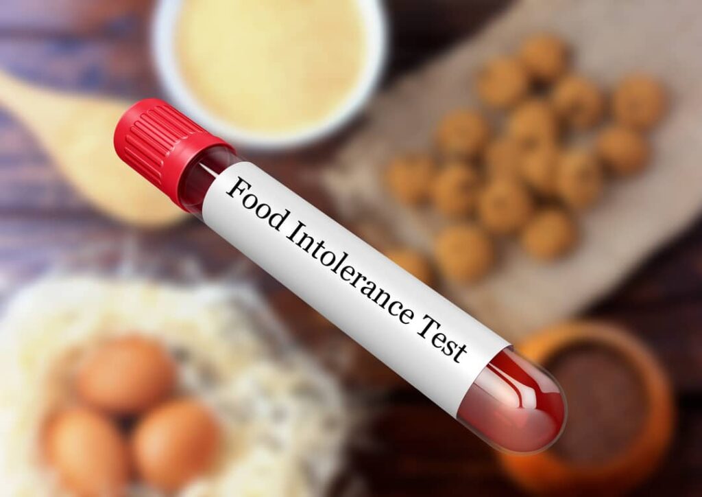 blood test at home dubai 2025 Doctor On Call