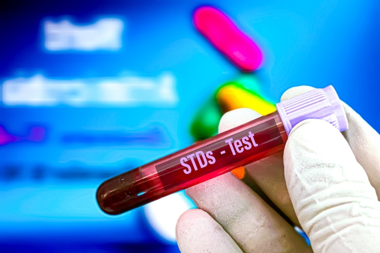 blood test at home dubai 2025 Doctor On Call