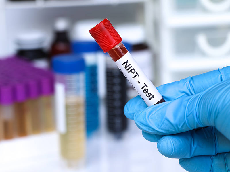blood test at home dubai 2025 Doctor On Call